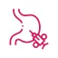 laproscopy